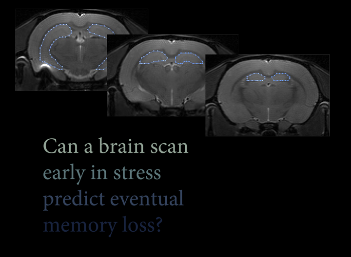 Can a brain scan early in stress predict eventual memory loss?