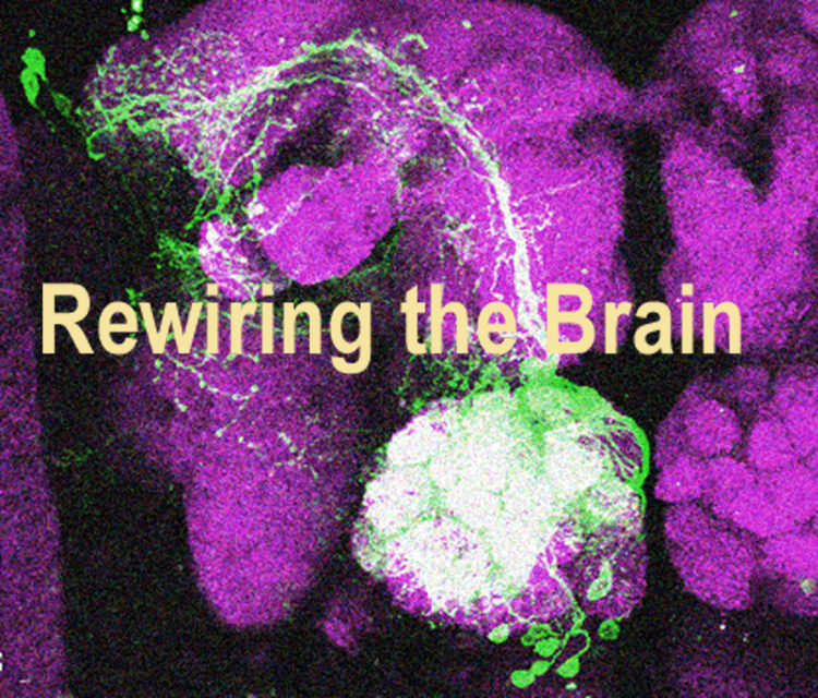 Rewiring the brain1