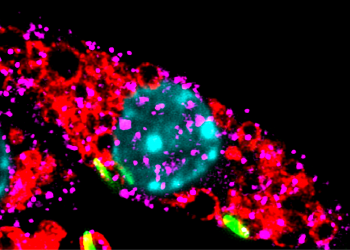 How Tuberculosis turns our defences against us