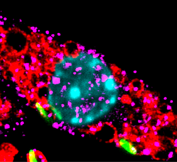 How Tuberculosis turns our defences against us