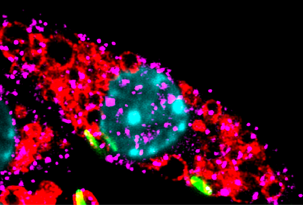 How Tuberculosis turns our defences against us