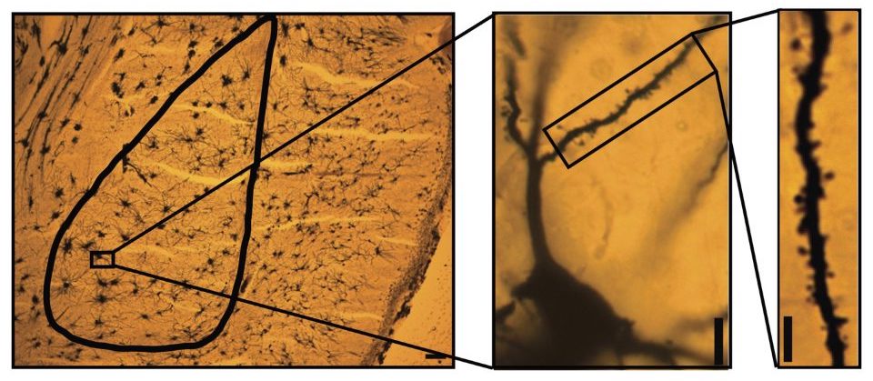 Representative image showing dendritic spines in neurons from the amygdala